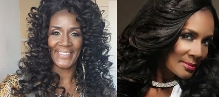 A picture of Momma Dee before (left) and after (right) Botox.